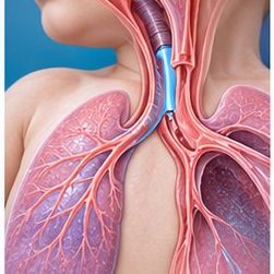 Medical illustration of Evaluation of congenital airway disorders